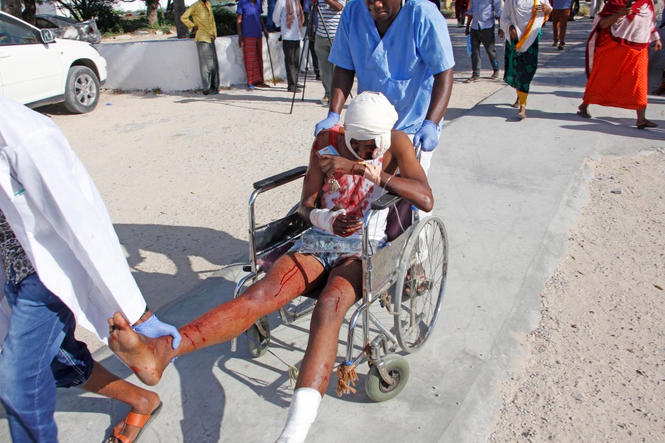  An explosion at a busy checkpoint in Somalia's capital wounded dozens on Saturday