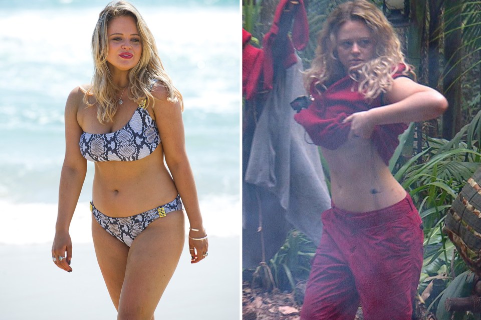  Emily Atack lifted her top to show her slimmer build after just one week on the brutal diet