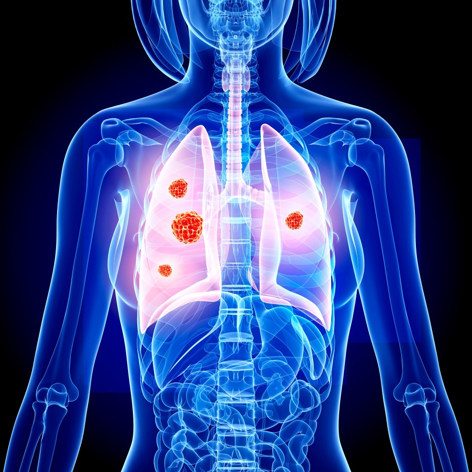 New research has found that there are two symptoms which could act as potential predictors of lung cancer