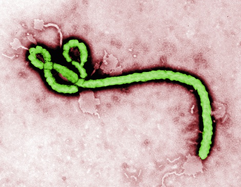  The Ebola virus, file microscope image, causes an acute, serious illness which is often fatal if untreated