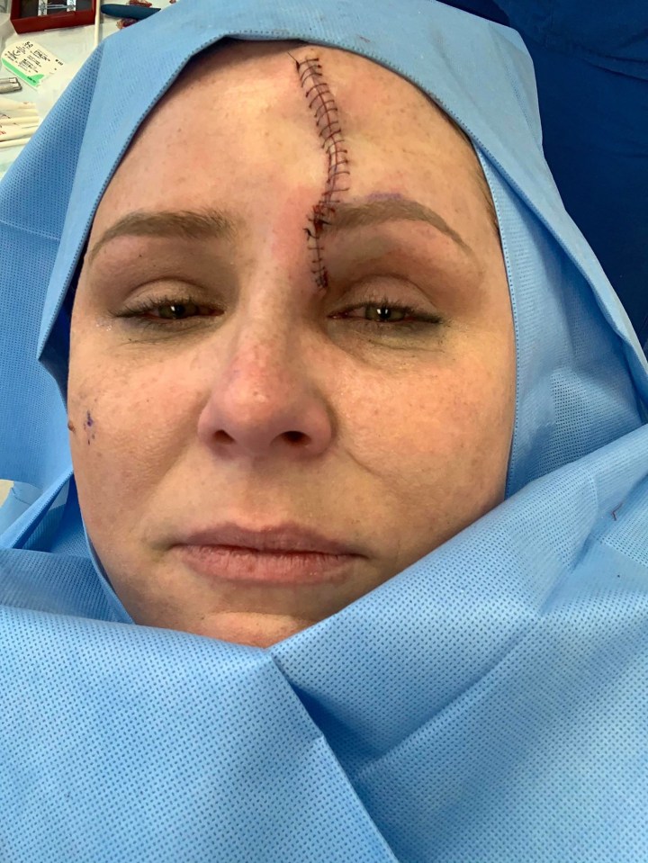 Carrie says she couldn’t stop crying when she saw the results of her surgery