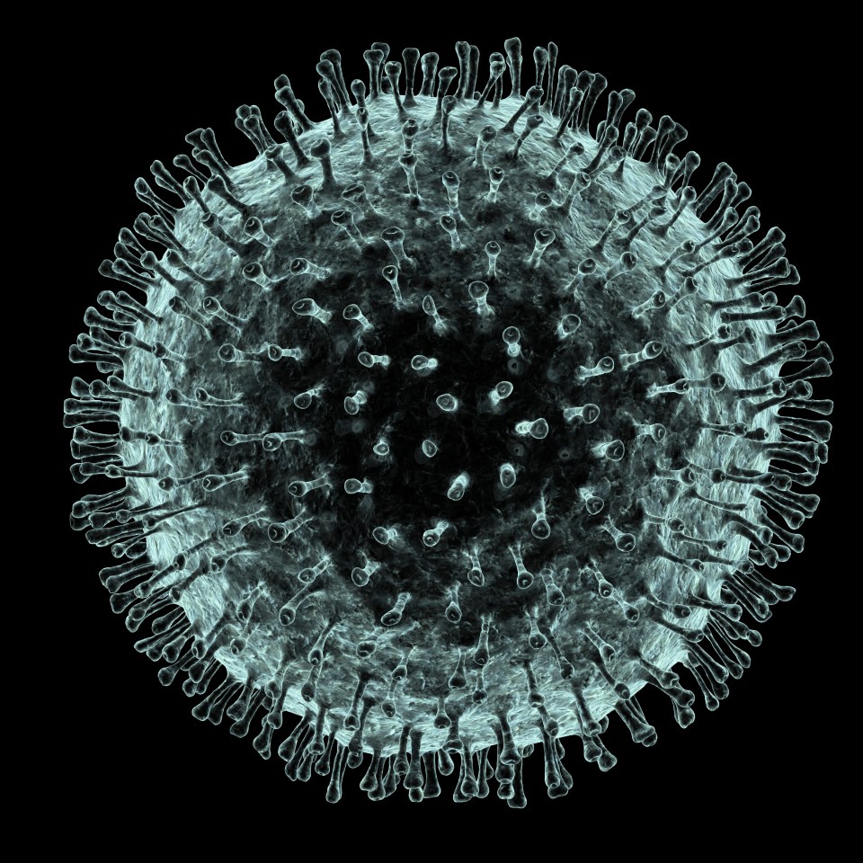 Severe acute respiratory syndrome (SARS) is caused by coronavirus, computer image of the infection