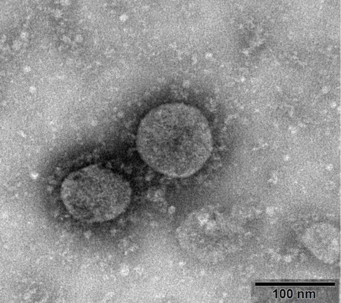 The first image of the coronavirus was shared by China's National Microbiology Data Center and shows particles taken from a patient on January 22