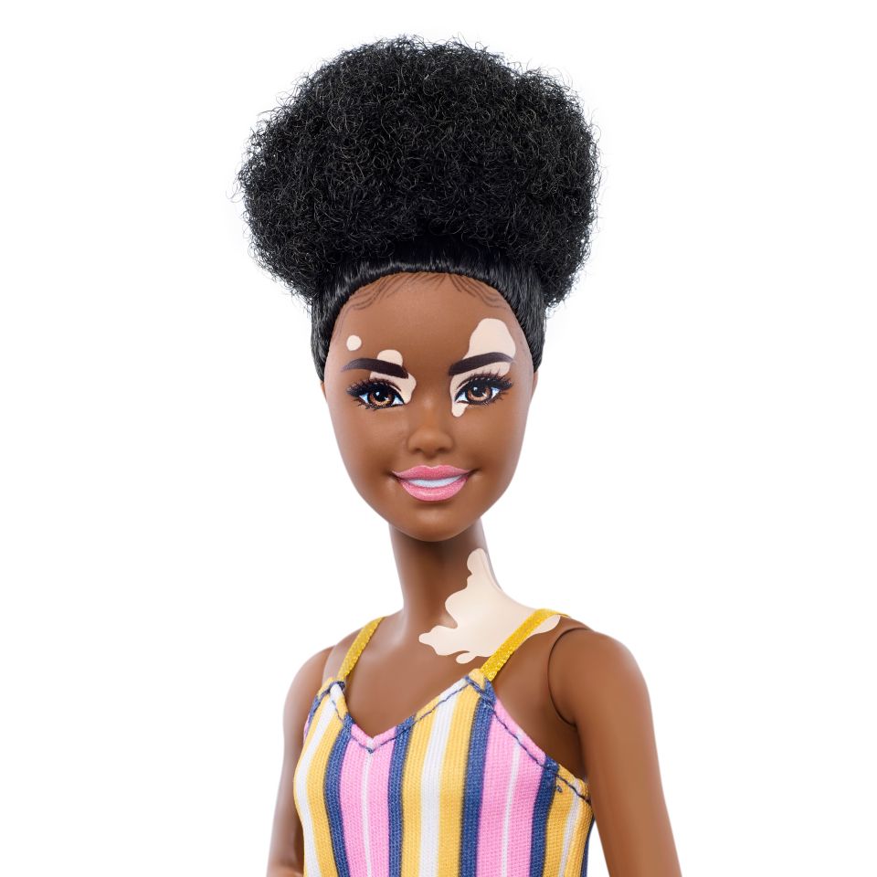  Barbie will now sell a version that looks as if it has the skin condition vitiligo