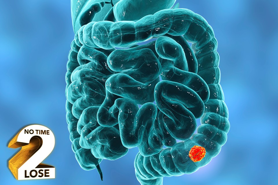 Bowel cancer is the fourth most common form of the disease in the UK