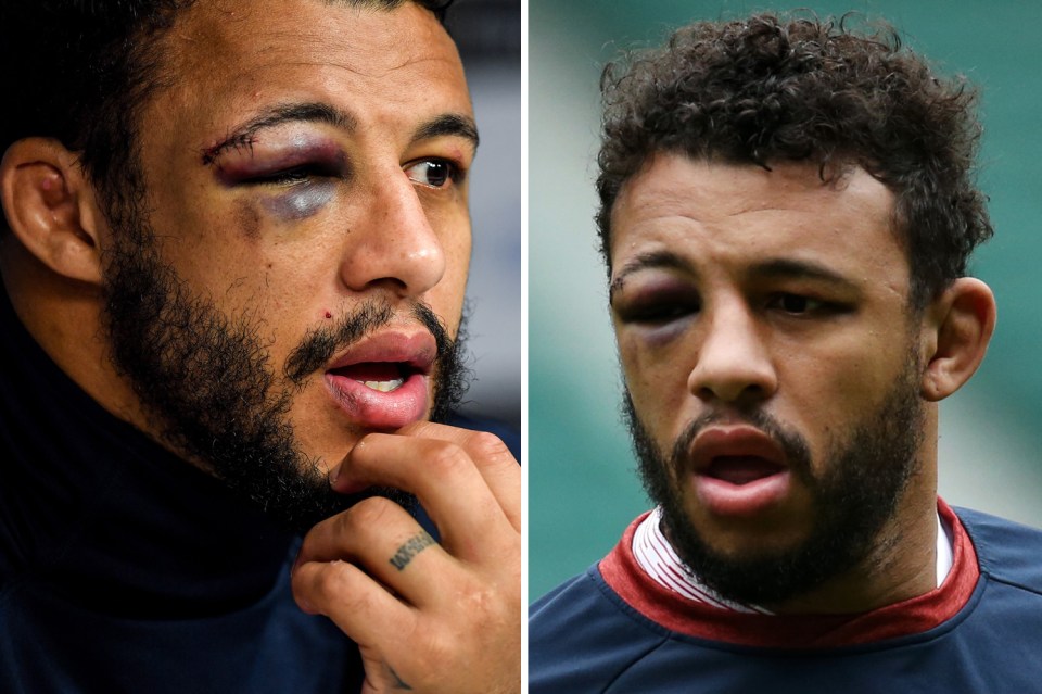  Courtney Lawes has been sporting an impressive shiner but will be keeping an eye on Ireland in the massive Six Nations test