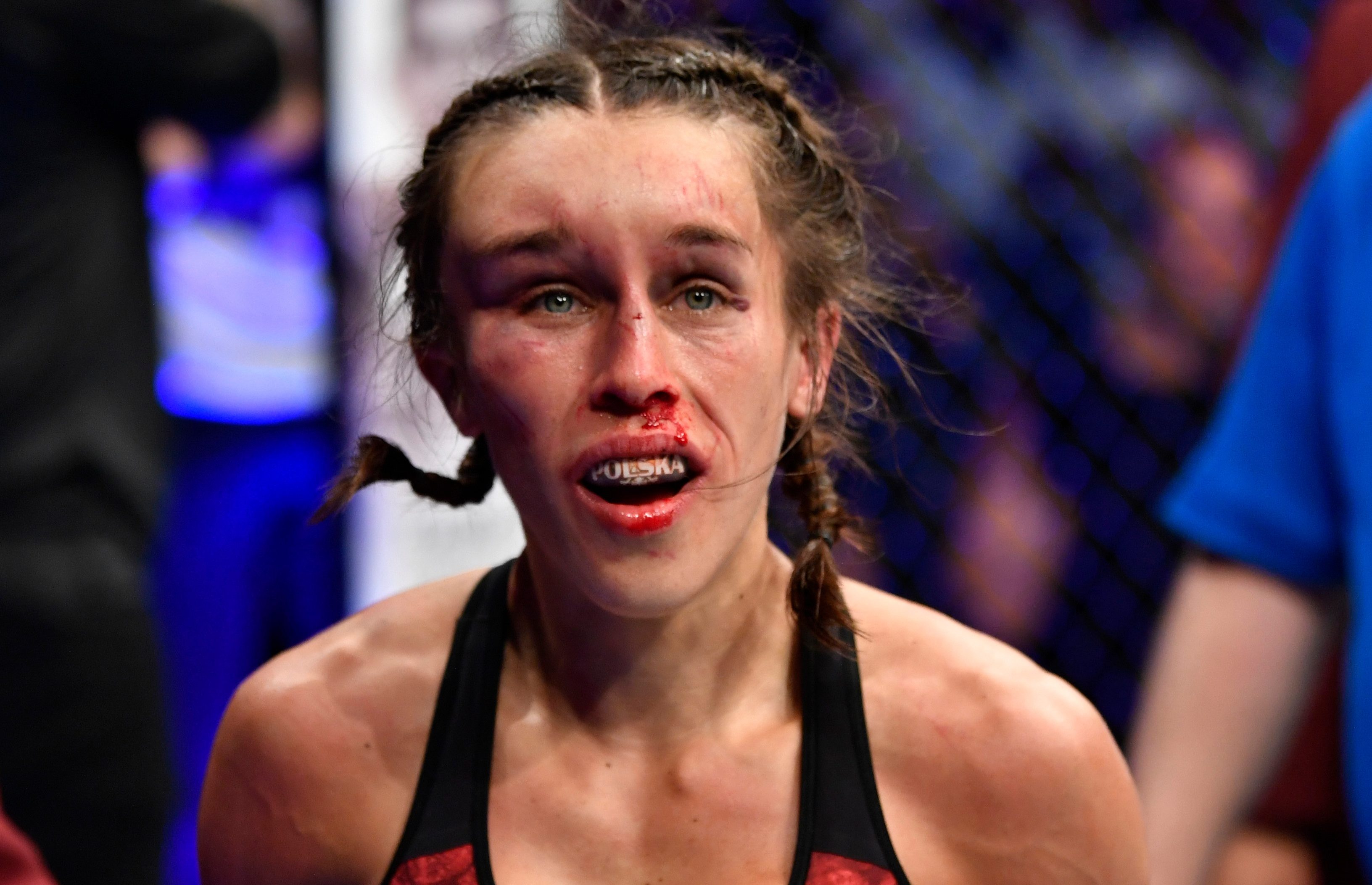 Jedrzejczyk was badly hurt after her defeat to Weili Zhang at UFC 248