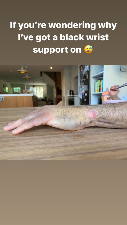  Joe had a minor operation last week