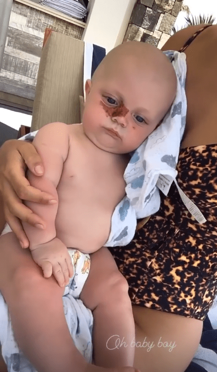  Four-month-old Beau has had a discoloured patch of irritation around his eye for several days now