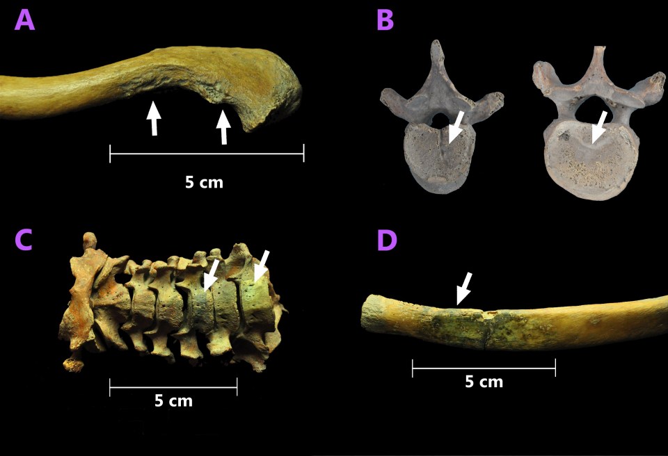 Damage to some of the bones suggest the suspected slaves were the victims of physical abuse before they died