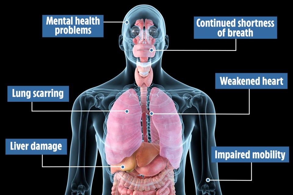 Coronavirus can cause lasting damage to a patient’s whole body