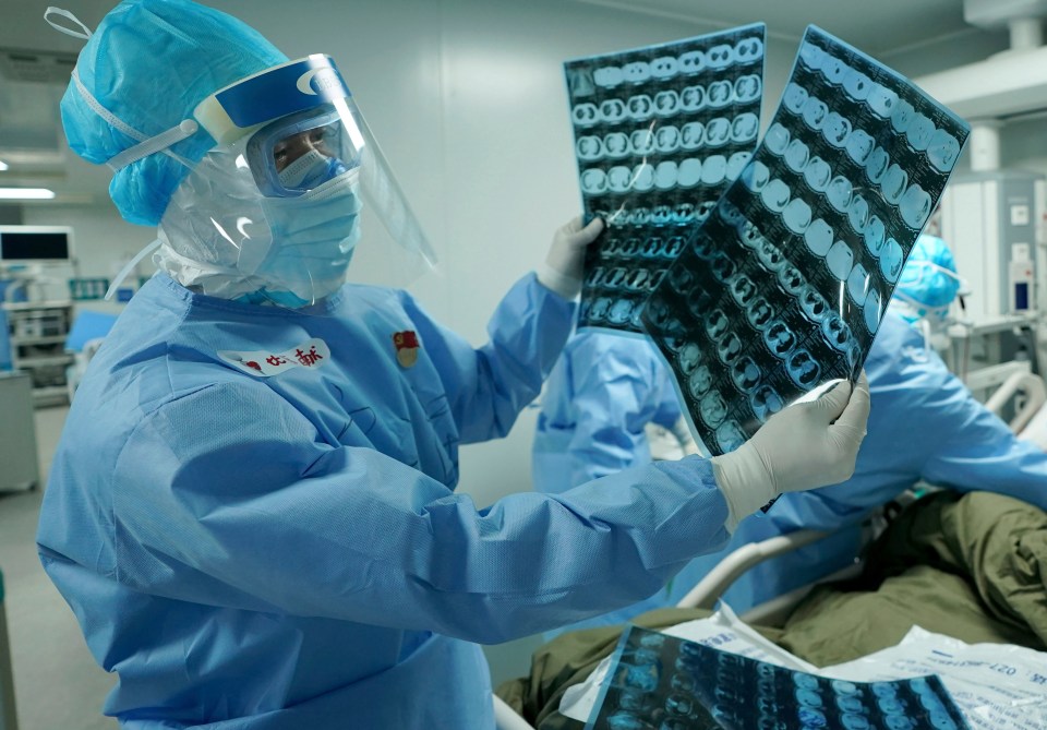  Medical worker looks at CT scans at the Huoshenshan field hospital in Wuhan on March 17