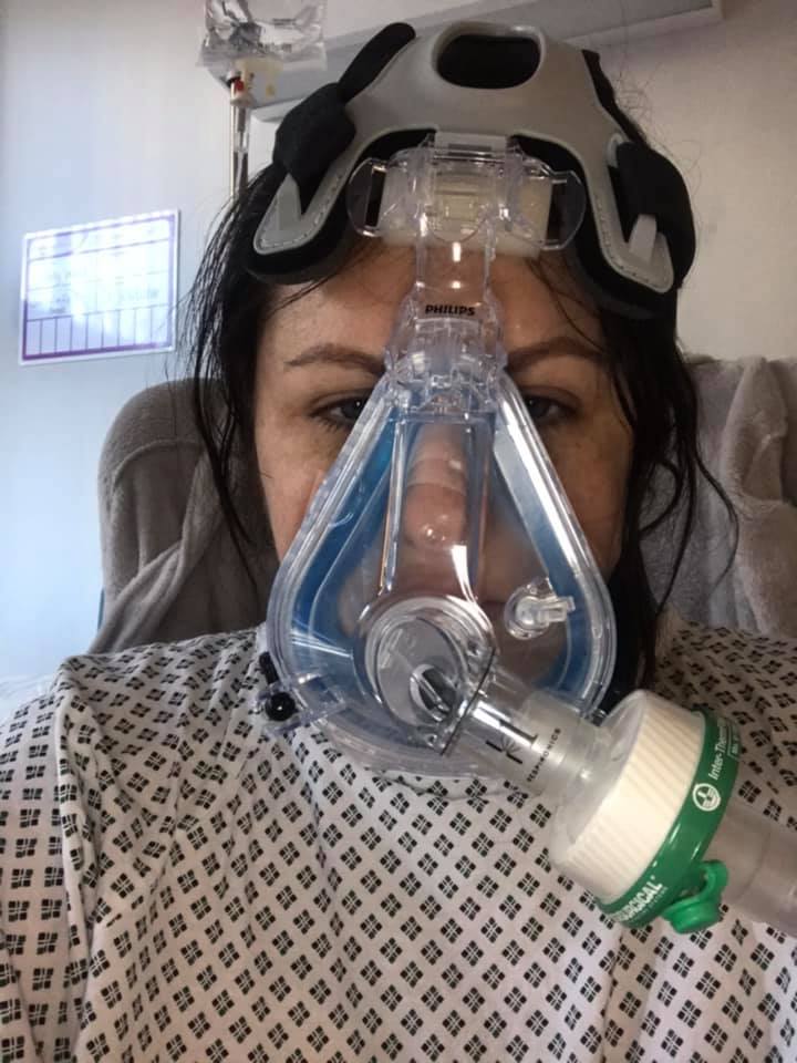  The mum-of-two was seriously ill on a CPAP ventilator