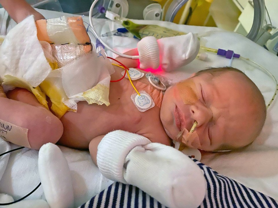 The condition meant he was also at risk of having a heart defect - but thankfully that was ruled out at 24 weeks