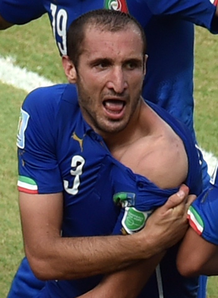  Giorgio Chiellini showed off his war wound after he was bitten by Luis Suarez