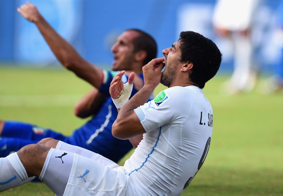  Luis Suarez held his teeth in pain after the bizarre incident