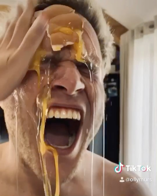  The singer ended up with egg on his face after one prank