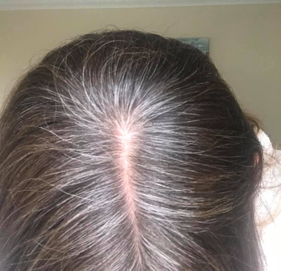  Before applying the product, her roots were visibly grey