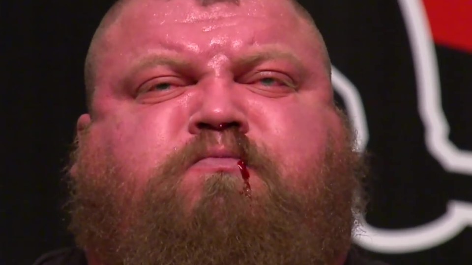  Eddie Hall's nose started to bleed as he pulled the weight off the ground