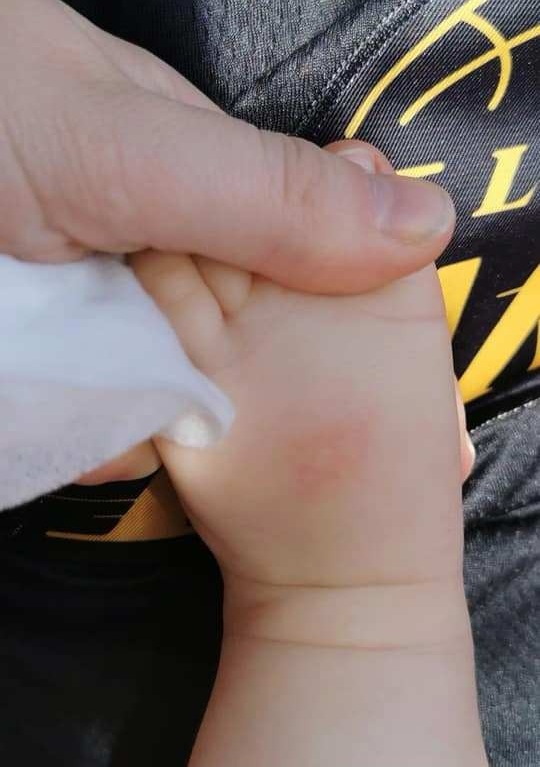 Chelsea's friend tried the sun cream on her nine-month-old baby