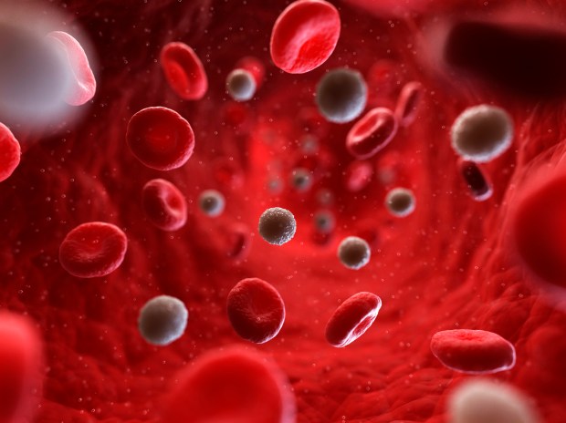 Blood is made up of red blood cells, white blood cells and platelets in a liquid called plasma