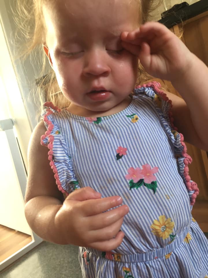 Chelsea Jones' two-year-old daughter Lily Mae suffered an extreme reaction to sun cream last week