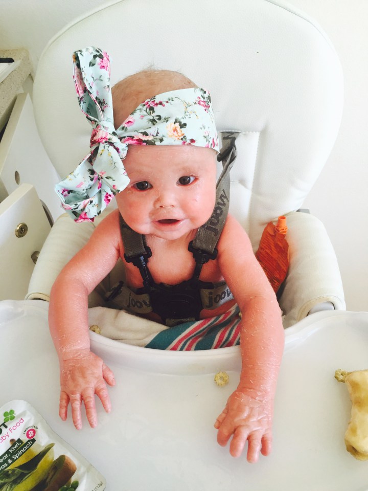 Bundle of joy: Little Harper is pictured above,  the picture shows the skin on her arms peeling