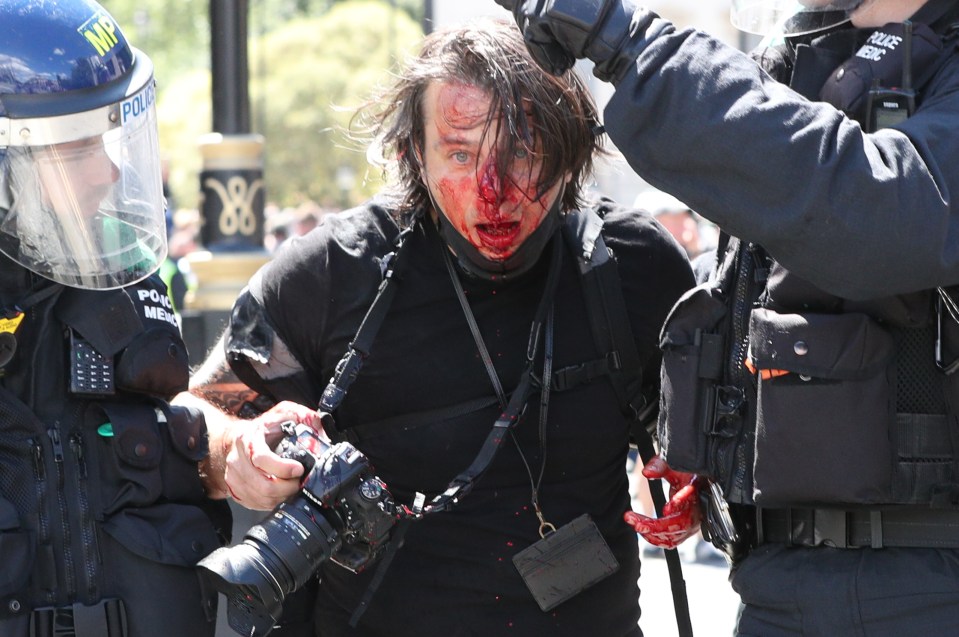 Police escort a photographer with blood on their face outside the Houses of Parliament in London