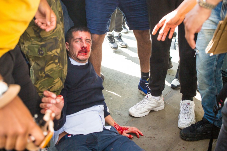 A man is left bloodied after clashes with BLM protesters in Trafalgar Square