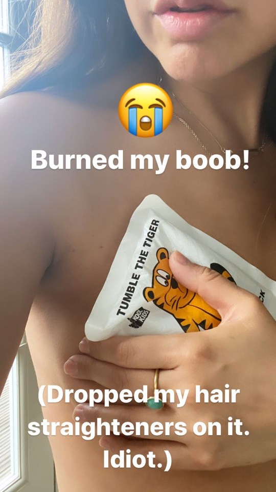  Myleene burned her boob this morning while getting ready for work