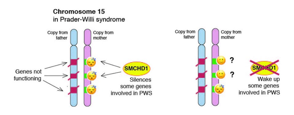  Those with PWS have a genetic defect on chromosome number 15