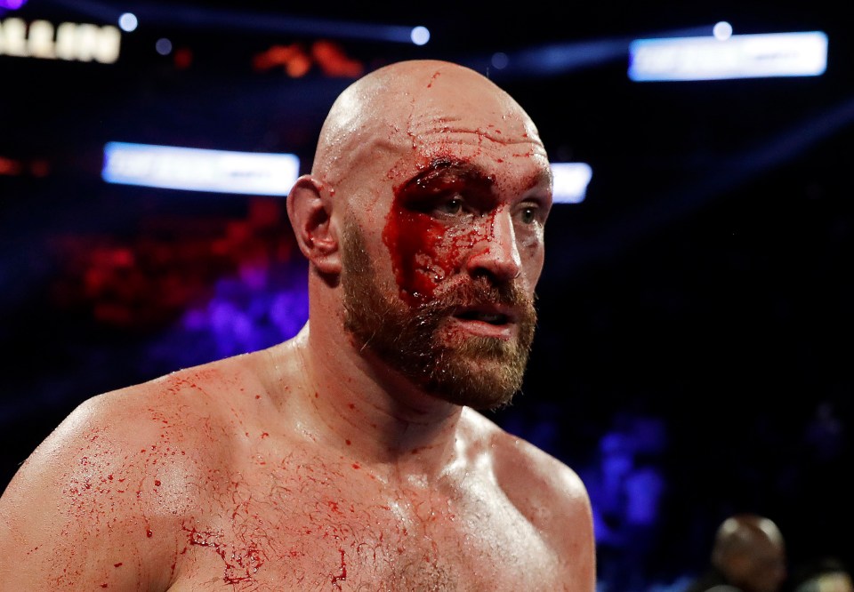 Tyson Fury suffered a horrendous cut against Otto Wallin that needed 47 stitches in afterwards