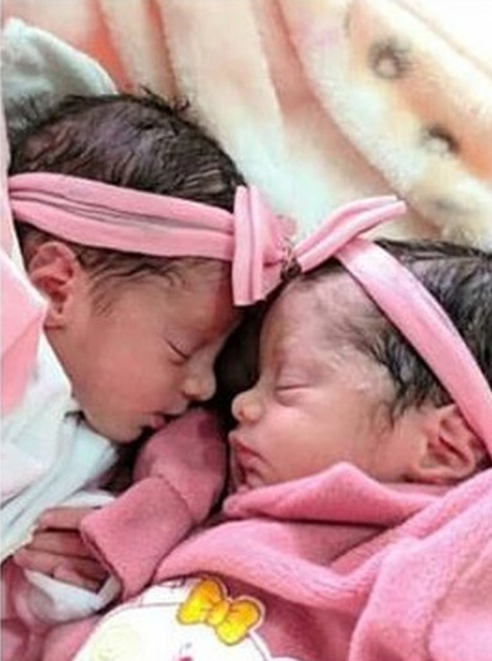 The twins only lived for 26 days