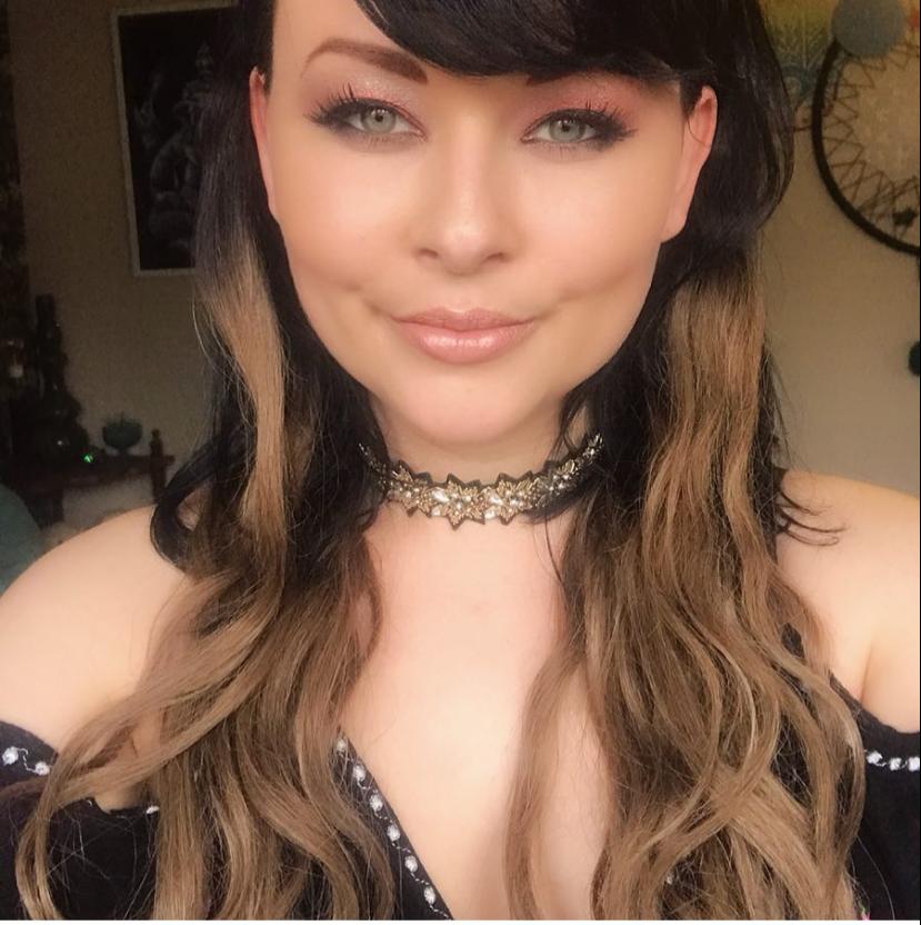 Aimee Godden developed psoriasis following a New Year’s Eve smooch