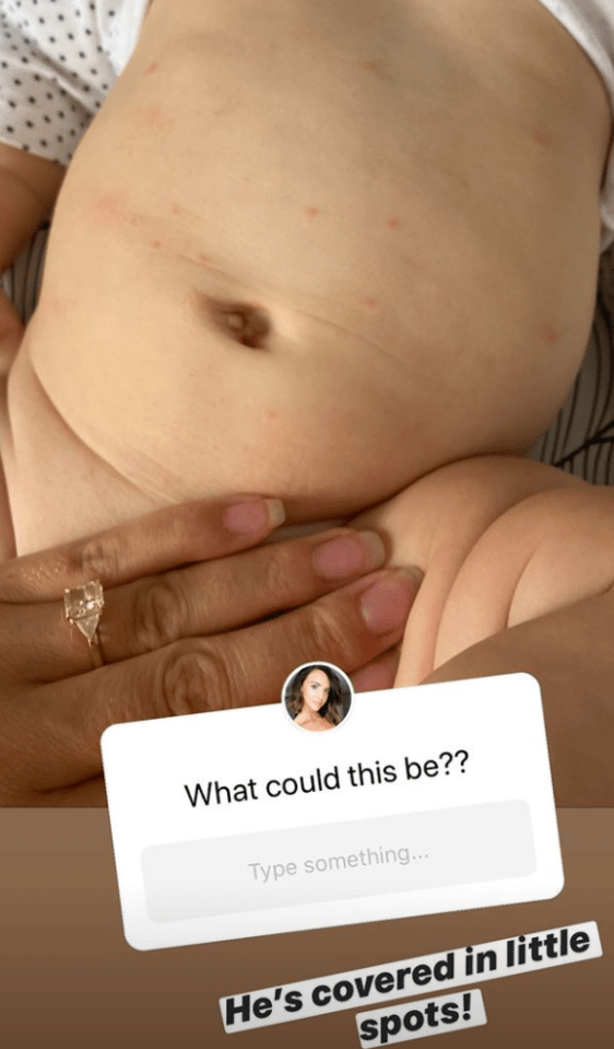 Later, Lucy shared a photo of Roman's stomach which showed him with small red spots