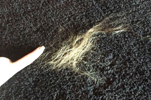 Heard has claimed Depp pulled out her hair during the incident