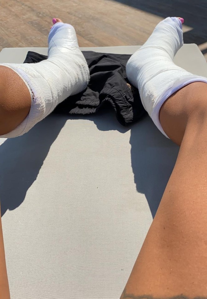 Katie Price has broken both of her feet during an accident on holiday