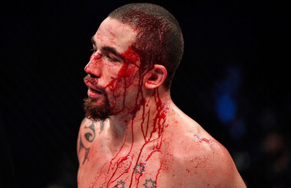 UFC star Robert Whittaker ended the fight with blood pouring from a cut