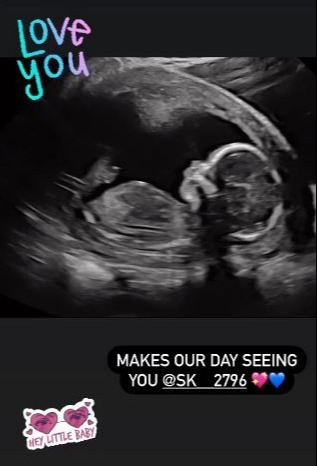 Dani recently shared a scan photo of her unborn baby