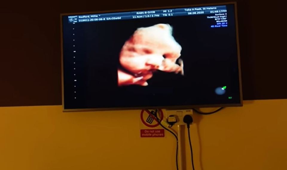 She had a 4D scan that revealed her baby was 6lb 9oz