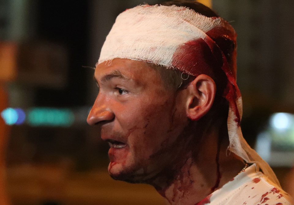 A demonstrator was left bloodied after a clash with police