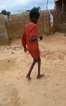 Jibril's legs are painfully thin, and he struggles to walk after living on goat food and poo