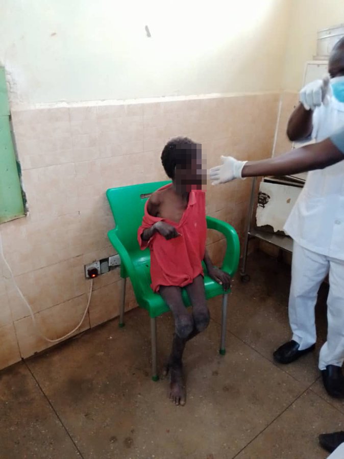 After his rescue at the weekend, Jibril was taken to a local hospital