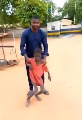 Jibril Aliyu struggled to walk when he was rescued from his hellhole family property in Nigeria