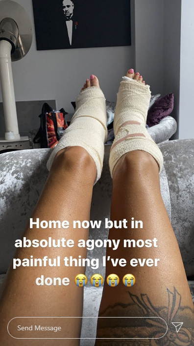 Katie managed to break both of her feet in a freak accident while she was out there