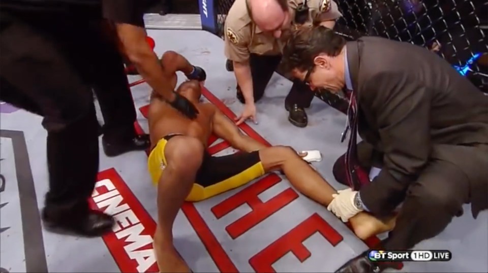 Anderson Silva snapped his ankle against Chris Wiedman in UFC