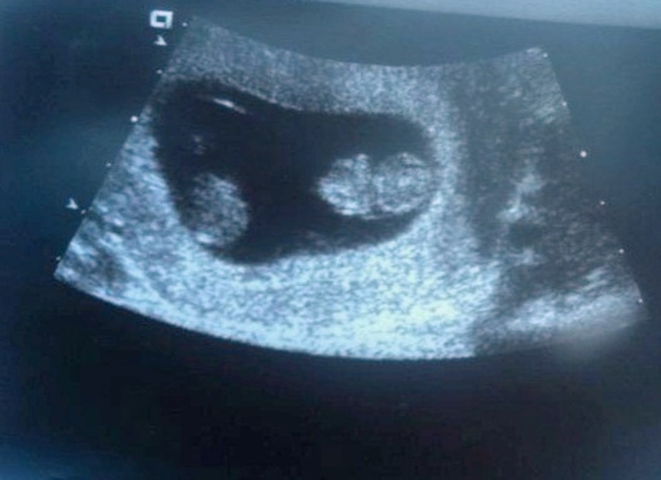 A scan from one of the women he inpregnanted