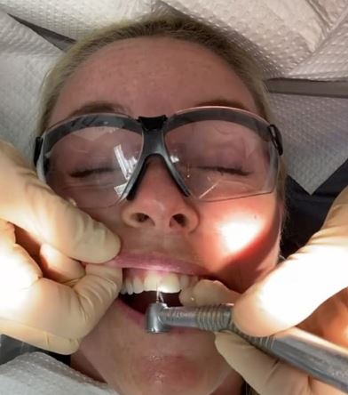 Lindsey Vonn shared behind-the-scenes footage of herself at the dentist getting veneers