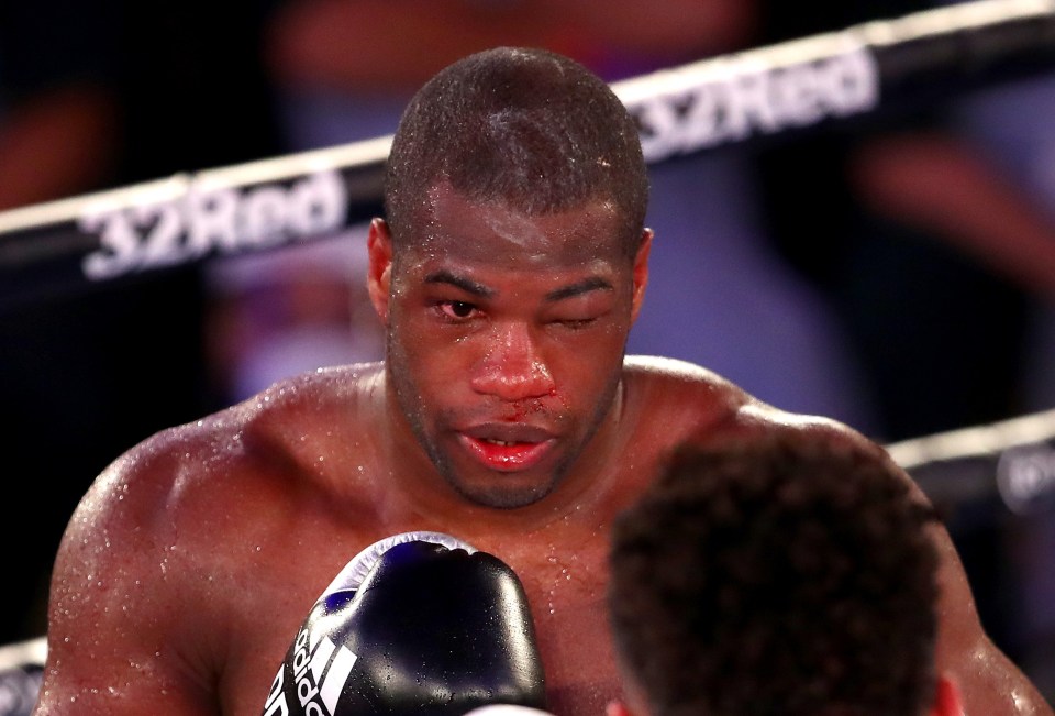 Daniel Dubois failed to make the referee's count in his defeat by Joe Joyce