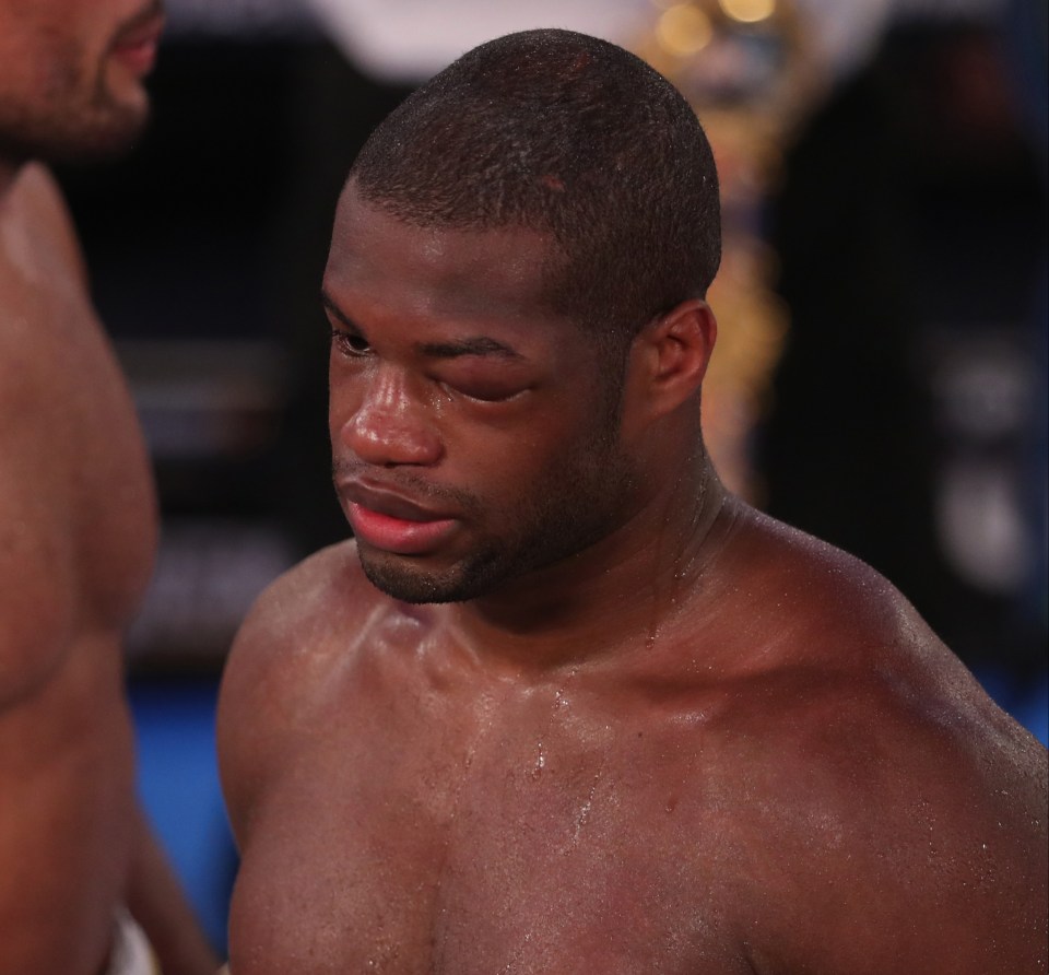 Daniel Dubois has a long journey back to world title contention, according to David Haye